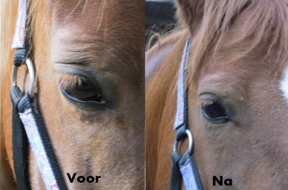 Voor_Na_Oog